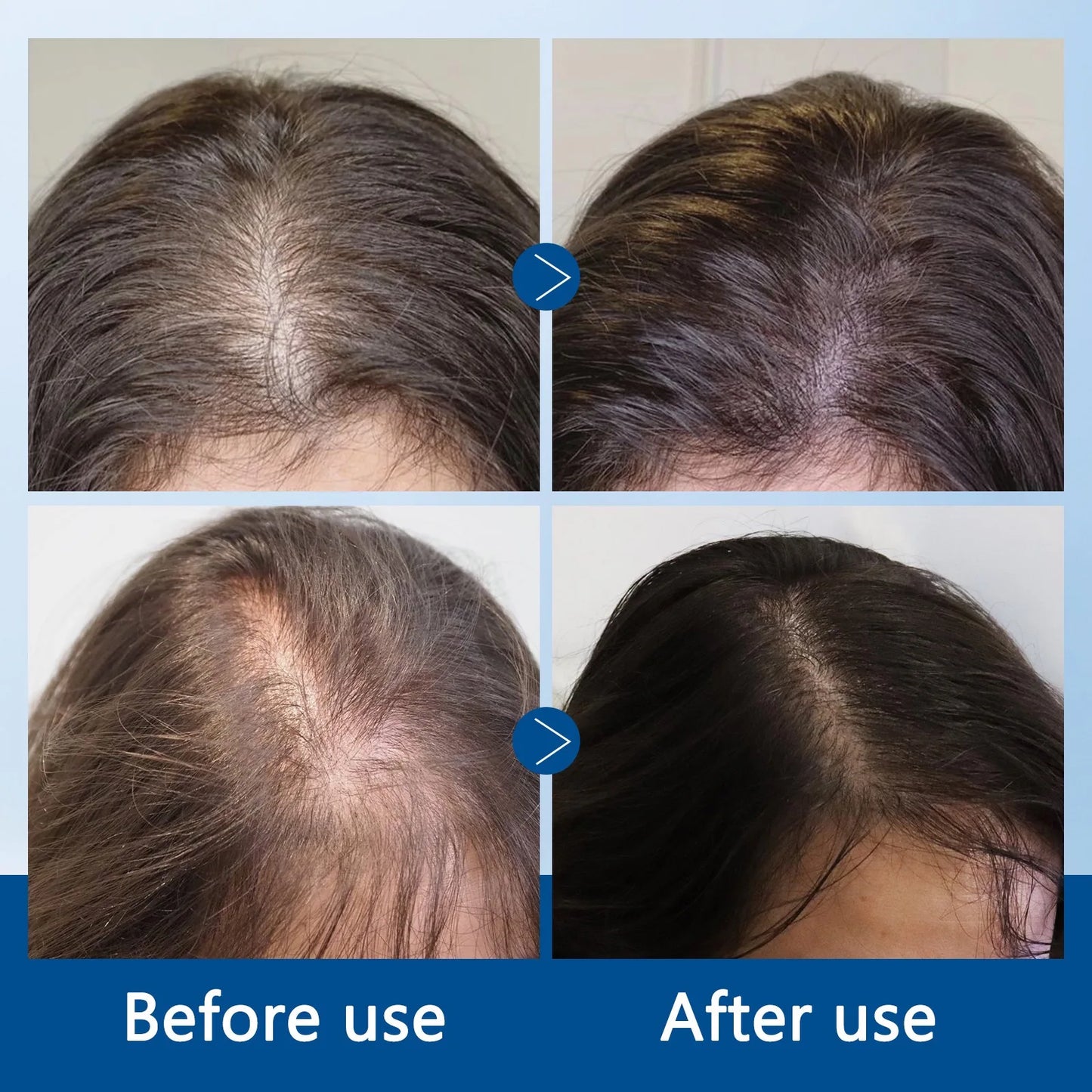 BodyWise Hair Roll-On Growth Serum