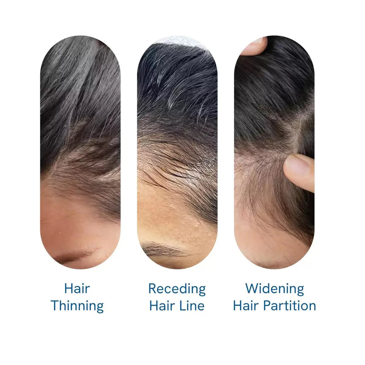 BodyWise Hair Roll-On Growth Serum