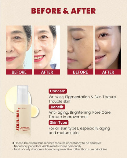 Seoul 1988 Ultimate Glow Serum